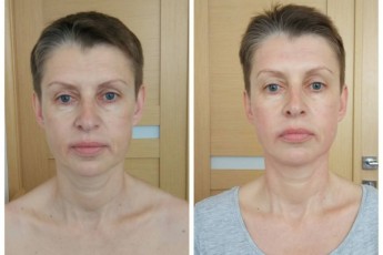 Абонемент. Вид 2
